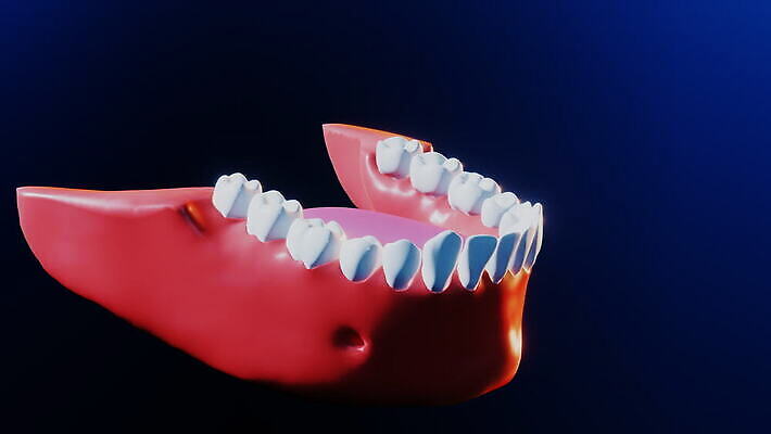 모델 과학 해부 왕관 건강 치과 사람 사람없음 치료 약 3D 흰색 도자기 입 치아 치과의사 만들기 뿌리 애니메이션 외과 턱 틀니 방법 보철 설치 위생관리 인공 잇몸 치아교정 치유 4K 구강학 MOV 해외동영상 클립영상 컬러 신체 의학 모션 병원 관리 신체부위 의사 소화기관 디지털합성 교정 동영상 파일형식