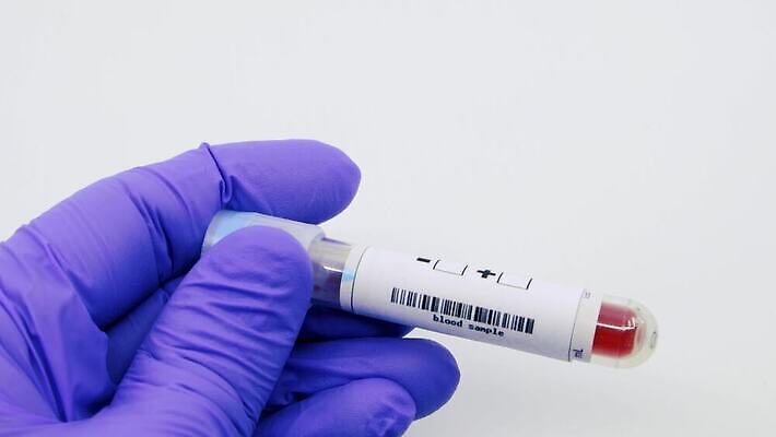 과학 실험 사람없음 치료 라벨 견본 건강관리 미국 중국 장비 의사 실험실 바이러스 결과 질병 컨테이너 수집 분석 시험관 긍정 감염 전염 튜브 박테리아 전염병 사스 코로나바이러스 4K 유체 MP4 해외동영상 클립영상 산업 아시아 컨셉 북아메리카 의학 프레임 건강 실험기구 관리 의료진 동영상 파일형식