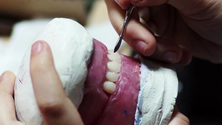 모델 손 여자 왕관 치과 병원 실험 약 기계 장비 의사 기구 공구 업무 작업 도자기 투명 기술자 실험실 치아 제조 보호 치과의사 외과 턱 틀니 돌봄 방법 보철 인공 치아교정 실종 4K MP4 해외동영상 클립영상 직업 컨셉 의학 모션 사람 신체부위 의료진 도구 소화기관 사건 교정 동영상 파일형식