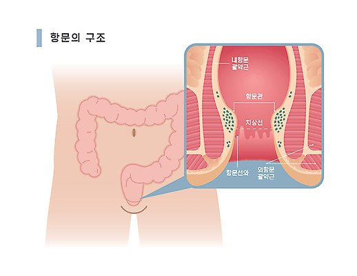일러스트 의학 신체부위 분석 대장 치질 항문 복부 항문선와 항문관 괄약근 국내일러스트 AI파일 컨셉 사람 소화기관 장기_의학 질병 파일형식 벡터