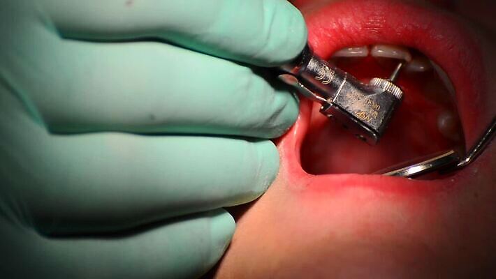 백인 직업 여자 산업 어린이 건강 치과 병원 사람 치료 약 장비 환자 의사 기구 오픈 입 닫기 치아 무서움 부식 치과의사 방문 순서 돌봄 명패 송곳 위생관리 잇몸 HD 구강학 MOV 해외동영상 클립영상 서양인 감정 신체 의학 모션 관리 신체부위 의료진 소화기관 동영상 파일형식