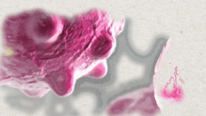 모양 과학 해부 세포 건강 현미경 사람없음 약 3D 건강관리 손상 고통 의사 수리 질병 유기농 생물학 만들기 미생물 충격 애니메이션 암 종양 탐지 MOV 해외동영상 클립영상 웰빙 교육 감정 컨셉 의학 모션 생물 실험기구 관리 의료진 디지털합성 동영상 파일형식