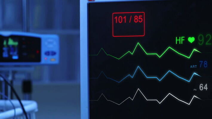 선 해부 프레임 기술 건강 병원 사람 사람없음 약 스크린 모니터 자료 기계 방 장비 환자 기구 하트 긴급 혈액 맥박 속도 감시 돌봄 바이탈 심전도 압력 MOV 해외동영상 클립영상 모양 의학 모션 컴퓨터 동영상 파일형식