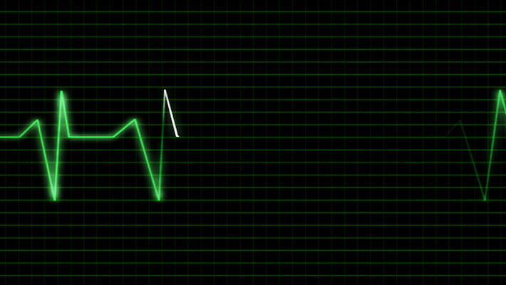 백그라운드 그래프 추상 병원 사람없음 모니터 환자 간호사 하트 죽음 플랫 맥박 감시 암 돌봄 심전도 지라 MOV 해외동영상 클립영상 모양 무늬 의학 모션 컴퓨터 의료진 질병 동영상 파일형식
