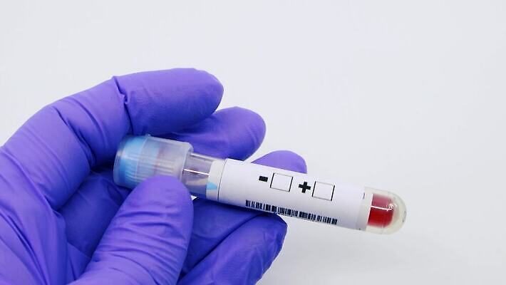 과학 실험 사람없음 치료 라벨 견본 건강관리 미국 중국 장비 의사 실험실 바이러스 결과 질병 컨테이너 수집 분석 시험관 긍정 감염 전염 튜브 박테리아 전염병 사스 코로나바이러스 4K 유체 MP4 해외동영상 클립영상 산업 아시아 컨셉 북아메리카 의학 프레임 건강 실험기구 관리 의료진 동영상 파일형식