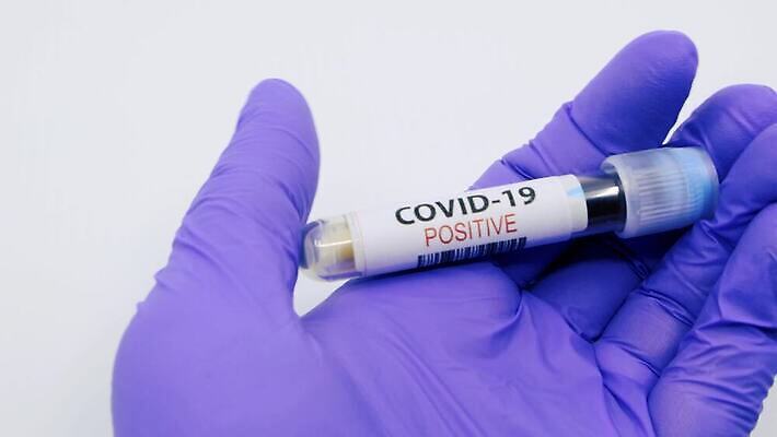 과학 실험 사람없음 치료 라벨 견본 건강관리 미국 중국 장비 의사 실험실 바이러스 결과 질병 컨테이너 수집 분석 시험관 긍정 감염 전염 튜브 박테리아 전염병 사스 코로나바이러스 4K 유체 MP4 해외동영상 클립영상 산업 아시아 컨셉 북아메리카 의학 프레임 건강 실험기구 관리 의료진 동영상 파일형식