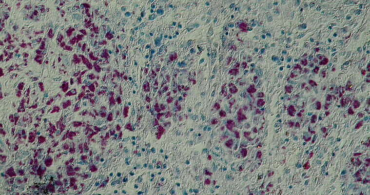 과학 이동 패턴 세포 사람없음 빨간색 파란색 약 시험 성장 조직 확대 질병 에이즈 지원 4K 현미경관찰 MOV 해외동영상 클립영상 교육 컬러 컨셉 무늬 의학 관찰 동영상 파일형식