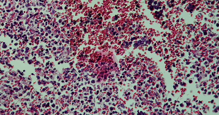 과학 이동 패턴 세포 사람없음 빨간색 파란색 약 시험 성장 조직 확대 질병 종양 지원 4K 현미경관찰 MOV 해외동영상 클립영상 교육 컬러 컨셉 무늬 의학 관찰 동영상 파일형식