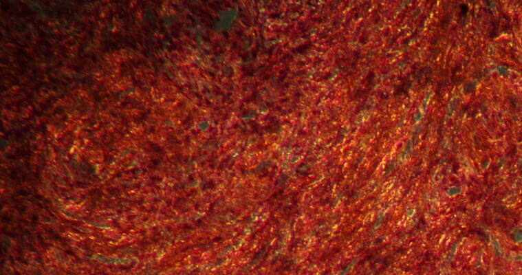 과학 이동 패턴 근육 세포 사람없음 빨간색 파란색 약 시험 성장 하트 조직 확대 질병 지원 4K 현미경관찰 MOV 해외동영상 클립영상 모양 교육 컬러 컨셉 무늬 의학 관찰 동영상 파일형식