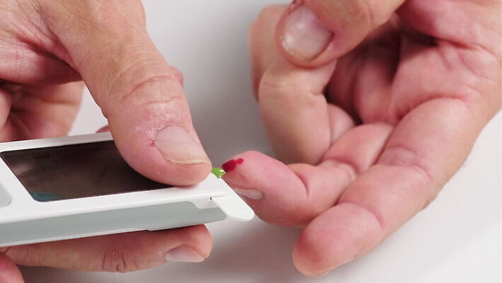 백인 손 컨셉 신체 손가락 건강 사람 치료 약 건강관리 모니터 고통 장비 환자 흰색 기구 막대기 혈액 떨어짐 질병 설탕 피부 분석 측정 확인 계량기 당뇨병 돌봄 인슐린 제어 포도당 4K MOV 해외동영상 클립영상 서양인 감정 컬러 의학 모션 관리 신체부위 컴퓨터 동영상 파일형식