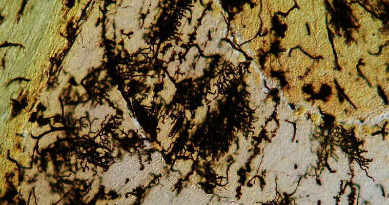 직업 과학 해부 상상 아이디어 병원 사람 사람없음 약 머리 마음 오르간 분석 뇌 생물학 하이테크 시스템 지능 4K MOV 해외동영상 클립영상 교육 컨셉 의학 기술 신체부위 건반악기 동영상 파일형식
