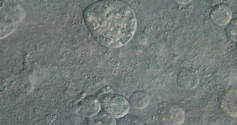 동물 교육 야생동물 과학 자연 생물 세포 현미경 사람없음 물 견본 연못 실험실 확대 생물학 미생물 원시시대 박테리아 4K MOV 해외동영상 클립영상 자연요소 의학 실험기구 실험 역사 생태계 동영상 파일형식