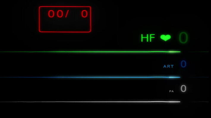 파도 백그라운드 해부 건강 병원 사람 사람없음 약 스크린 모니터 기계 장비 환자 기구 하트 긴급 죽음 혈액 맥박 사인 속도 감시 서명 산소 돌봄 바이탈 심전도 압력 MOV 해외동영상 클립영상 모양 바다 의학 모션 컴퓨터 원소 동영상 파일형식