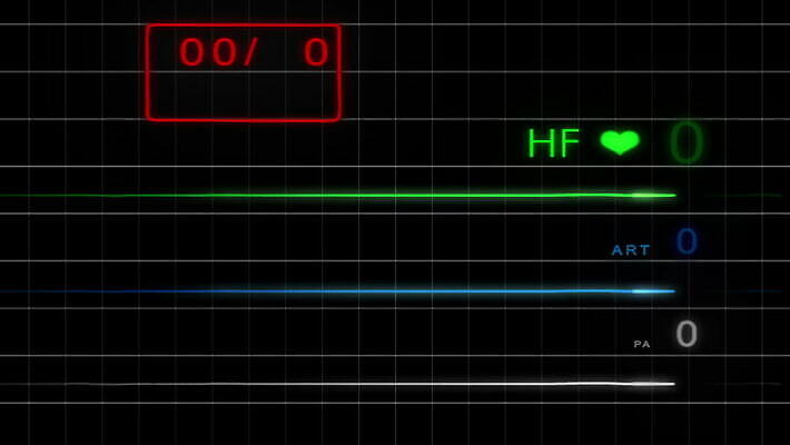 파도 백그라운드 해부 건강 병원 사람 사람없음 약 스크린 모니터 기계 장비 환자 기구 하트 긴급 죽음 혈액 맥박 사인 속도 감시 서명 산소 돌봄 바이탈 심전도 압력 MOV 해외동영상 클립영상 모양 바다 의학 모션 컴퓨터 원소 동영상 파일형식