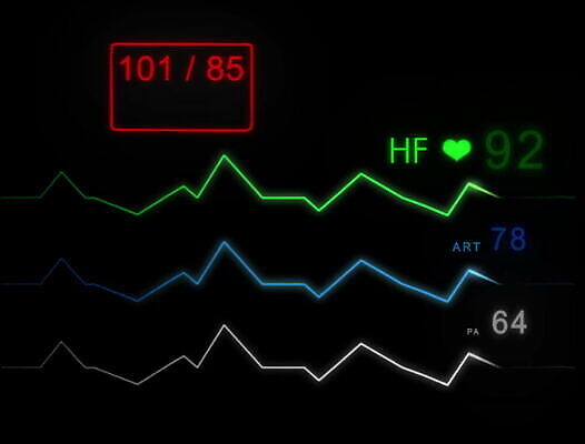 파도 백그라운드 해부 건강 병원 사람 사람없음 약 스크린 모니터 기계 장비 환자 기구 하트 긴급 죽음 혈액 맥박 사인 속도 감시 서명 산소 돌봄 바이탈 심전도 압력 4K MOV 해외동영상 클립영상 모양 바다 의학 모션 컴퓨터 원소 동영상 파일형식