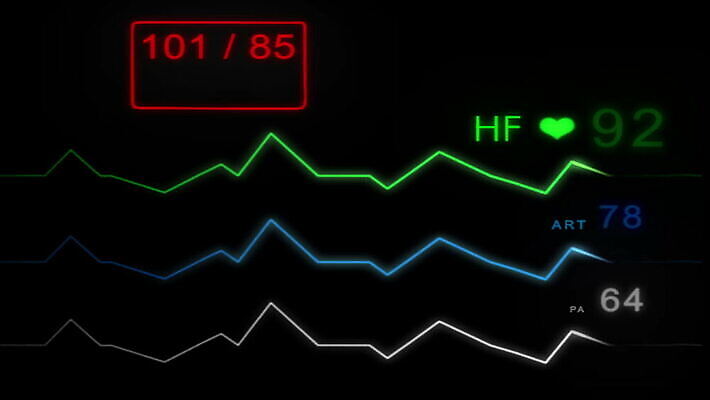 파도 백그라운드 해부 건강 병원 사람 사람없음 약 스크린 모니터 기계 장비 환자 기구 하트 긴급 죽음 혈액 맥박 사인 속도 감시 서명 산소 돌봄 바이탈 심전도 압력 MOV 해외동영상 클립영상 모양 바다 의학 모션 컴퓨터 원소 동영상 파일형식