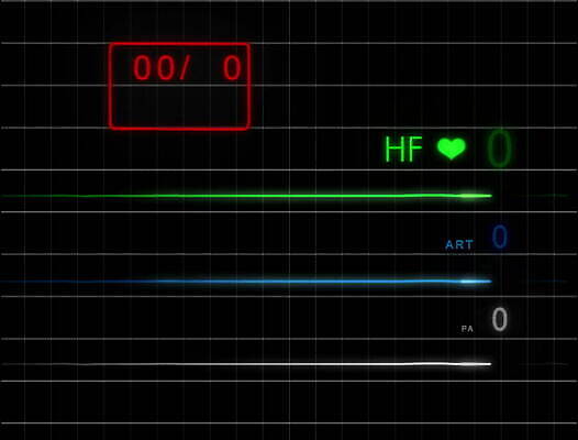 파도 백그라운드 해부 건강 병원 사람 사람없음 약 스크린 모니터 기계 장비 환자 기구 하트 긴급 죽음 혈액 맥박 사인 속도 감시 서명 산소 돌봄 바이탈 심전도 압력 4K MOV 해외동영상 클립영상 모양 바다 의학 모션 컴퓨터 원소 동영상 파일형식