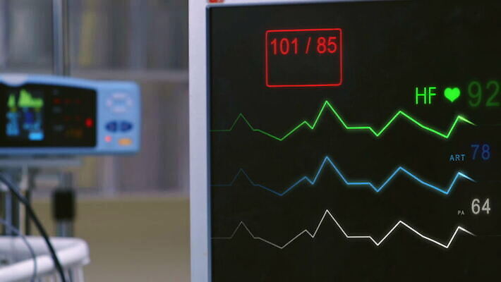 선 해부 프레임 기술 건강 병원 사람 사람없음 약 스크린 모니터 자료 기계 방 장비 환자 기구 하트 긴급 혈액 맥박 속도 감시 돌봄 바이탈 심전도 압력 MOV 해외동영상 클립영상 모양 의학 모션 컴퓨터 동영상 파일형식