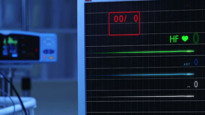선 파도 프레임 기술 건강 병원 사람 사람없음 약 스크린 모니터 자료 기계 방 장비 환자 하트 긴급 죽음 혈액 맥박 속도 감시 바이탈 심전도 압력 비어있는 MOV 해외동영상 클립영상 모양 바다 의학 컴퓨터 동영상 파일형식