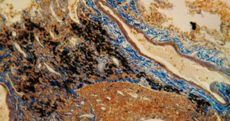 과학 이동 세포 사람없음 빨간색 파란색 약 시험 성장 조직 확대 질병 지원 4K 현미경관찰 MOV 해외동영상 클립영상 교육 컬러 컨셉 의학 관찰 동영상 파일형식