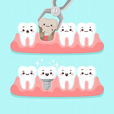 캐릭터 응시 하늘색 일러스트 표정 치과 웃음 사람없음 잡기 치아 치과용품 치과진료 뽑기 썩음 임플란트 충치 의학캐릭터 월간캐릭터 일러캐릭터 AI파일 시선 모션 병원 파란색 진료 의료용품 소화기관 질병 파일형식 벡터
