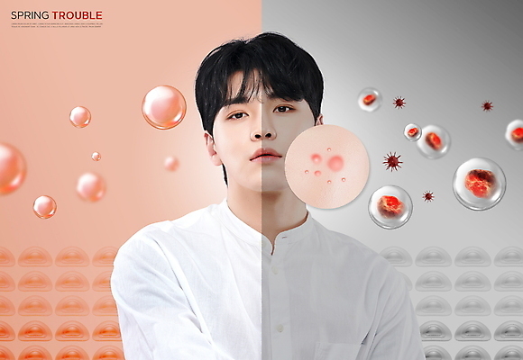 PSD 편집이미지 응시 남자 한명 상반신 20대 성인 봄 회색 한국인 피부 박테리아 여드름 피부질환 염증 트러블 환절기 의료성형뷰티 성인남자한명만 코랄 이미지편집 1 시선 계절 컬러 의학 사람 동양인 청년 신체부위 질병 남자한명만 성인남자만 파일형식