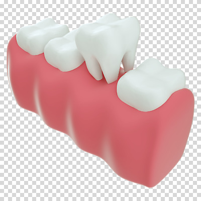 편집 편집이미지 누끼 사람없음 3D소스 3D 치아 디지털합성 치아모형 PNG 치과진료 발치 뽑기 잇몸 편집소스 신체 진료 소화기관 파일형식