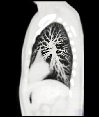 포토 JPG 해외이미지 과학 백그라운드 해부 엑스레이 건강 병원 사람 사람없음 3D 환자 심장 투명 허파 질병 흉부 주사약 궤 방사선 심장병 코로나바이러스 해외202309 해외포토 의학 약 장기_의학 호흡기관 바이러스 디지털합성 파일형식