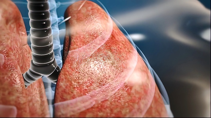 포토 JPG 해외이미지 과학 컨셉 해부 건강 사람없음 내부 치료 약 손상 고통 환자 광선 관찰 투명 오르간 허파 호흡기관 바이러스 호흡 질병 미생물 시스템 기침 돌봄 방사선 염증 전염병 현실 코로나바이러스 해외202309 해외포토 감정 의학 모션 생물 장기_의학 건반악기 파일형식