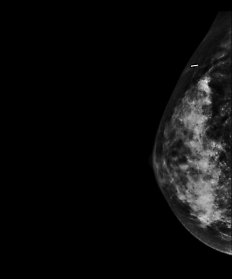 포토 JPG 해외이미지 여자 2 건강 병원 사람없음 시험 환자 의사 성장 수비 오르간 질병 가슴 확인 예방 유방암 암 외과 발견 의심 방사선 탐지 해외202309 해외포토 교육 감정 의학 모션 사람 신체부위 의료진 건반악기 파일형식