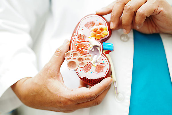 포토 JPG 해외이미지 건강 한명 상반신 성인 모형 의사 잡기 신장 질병 증상 성인한명만 해외202309 해외포토 1 의학 모션 사람 의료진 비뇨기관 성인만 파일형식