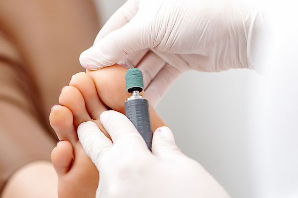 포토 JPG 해외이미지 직업 손 여자 장갑 신체 손가락 건강 사람없음 치료 뷰티 상점 스파 기계 화장품 환자 기구 공구 마사지 못 씻기 미용사 소중 피부 서비스 광택 닦기 순서 돌봄 방법 양발 정형외과 페디큐어 하드웨어 유일 해외202309 해외포토 잡화 컨셉 의학 모션 병원 사람 신체부위 컴퓨터 청결 도구 파일형식