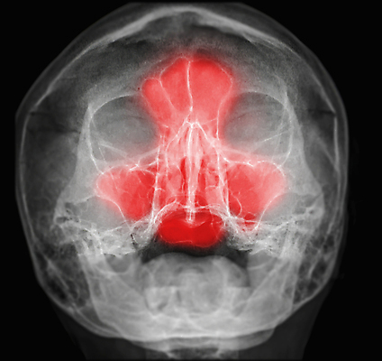 포토 JPG 해외이미지 얼굴 과학 일러스트 전구 해부 건강 사람 사람없음 치료 머리 고통 추위 구멍 호흡기관 바이러스 질병 코 두통 감염 미생물 암 알레르기 염증 재채기 코로나바이러스 해외202309 해외포토 감정 의학 생물 신체부위 장기_의학 파일형식