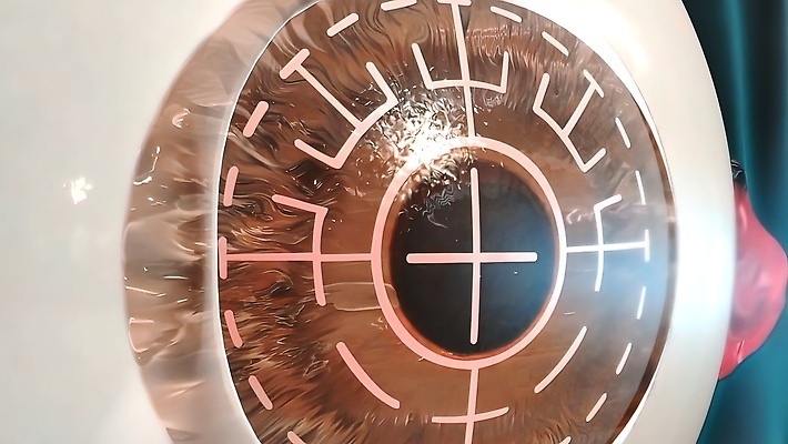 포토 JPG 해외이미지 직업 손 디자인 응시 얼굴 장갑 탁자 병원 가면 사람 사람없음 컴퓨터 약 3D 방 장비 환자 의사 램프 긴급 센터 수술 보호 눈동자 피부 시력 붓꽃 외과 동맥 순서 돌봄 치유 검안사 해외202309 해외포토 시선 잡화 꽃 가구 컨셉 의학 모션 조명 신체부위 치료 전자제품 의료진 눈_신체부위 디지털합성 혈관 파일형식 안경사