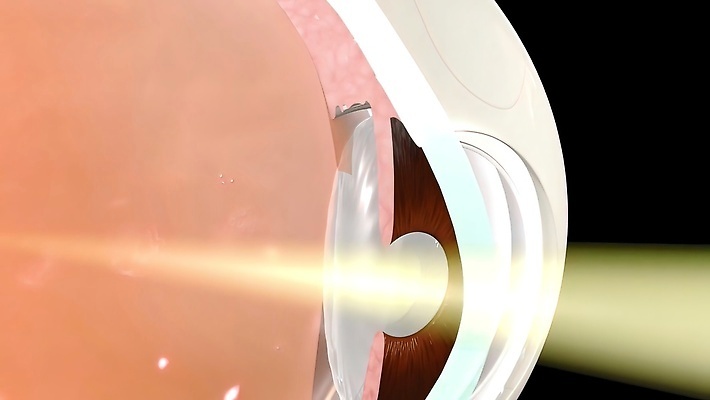 포토 JPG 해외이미지 학생 응시 파도 모션 사람 성인 사람없음 파란색 뷰티 갈색 우주 줄무늬 활발 펼침 닫기 떨어짐 눈동자 속눈썹 질감 시력 비전 붓꽃 정맥 노려봄 시력검사 카메라렌즈 강렬 광학 깜빡이다 해외202309 해외포토 시선 꽃 바다 컬러 컨셉 무늬 표정 카메라 눈_신체부위 눈썹 검사_조사 혈관 파일형식