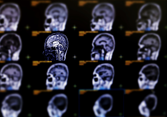 포토 JPG 해외이미지 엑스레이 건강 병원 사람없음 치료 약 머리 고통 환자 질병 뇌 함선 두통 동맥 방사선 종양 타격 해골모형 해외202309 해외포토 감정 배_교통 의학 모션 신체부위 모형 혈관 파일형식