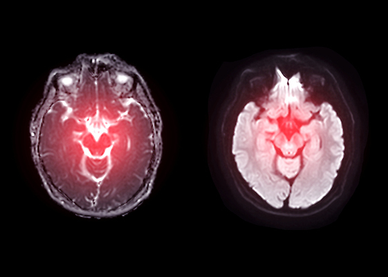 포토 JPG 해외이미지 과학 해부 건강 병원 사람없음 약 머리 시험 질병 분석 뇌 두통 자석 방사선 스캐너 스캔 치매 타격 패닝샷 해골모형 코로나바이러스 해외202309 해외포토 교육 컨셉 의학 모션 촬영기법 신체부위 모형 바이러스 파일형식