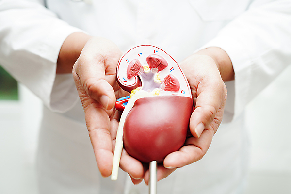 포토 JPG 해외이미지 건강 한명 상반신 성인 모형 의사 잡기 신장 질병 증상 성인한명만 해외202309 해외포토 1 의학 모션 사람 의료진 비뇨기관 성인만 파일형식