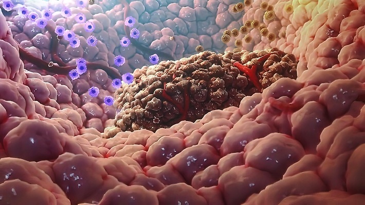 포토 JPG 해외이미지 과학 일러스트 세포 사람없음 컴퓨터그래픽 건강관리 바이러스 확대 질병 생물학 만들기 미생물 암 박테리아 췌장 종양 해외202309 해외일러스트 교육 의학 모션 생물 건강 관리 그래픽 장기_의학 파일형식