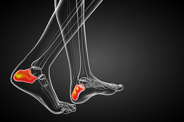 포토 JPG 해외이미지 뼈 골격 건강 사람 사람없음 고통 환자 발목 양발 정형외과 해외202004 해외포토 감정 의학 발 병원 파일형식