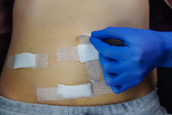 포토 JPG 해외이미지 손 여자 유럽 장갑 신체 해부 건강 사람 성인 사람없음 빨간색 뷰티 약 고통 시험 간호사 의사 조직 수술 자르기 날씬함 허리 피부 외과 허리둘레 삭제 염증 종양 흉터 해외202309 해외포토 잡화 교육 감정 나라 컬러 의학 모션 병원 신체부위 치료 의료진 둘레 질병 상처 몸매 파일형식