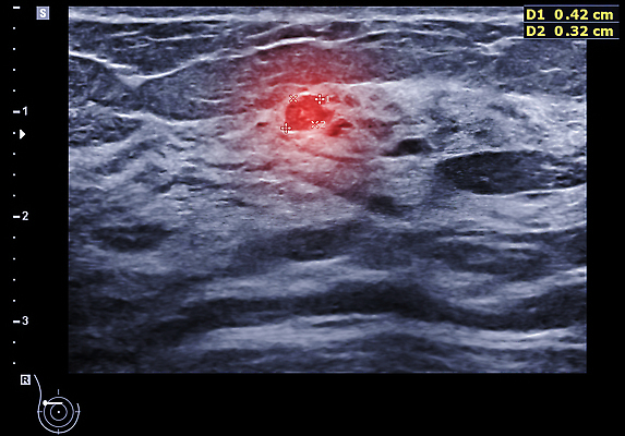 포토 JPG 해외이미지 직업 직장 실내 건강 병원 사람 사람없음 내부 치료 스크린 방 시험 환자 간호사 의사 질병 예측 가슴 예방 방문 유방암 암 궤 스캔 조언 종양 해외202309 해외포토 교육 컨셉 회사 의학 신체부위 의료진 파일형식