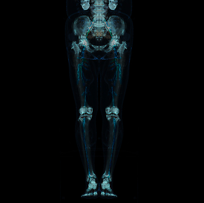 포토 JPG 해외이미지 해부 뼈 골격 엑스레이 사람없음 3D 질병 엉덩이 사건 무릎 시스템 허벅지 발목 골절 스캐너 양발 해외202309 해외포토 의학 발 신체부위 디지털합성 파일형식