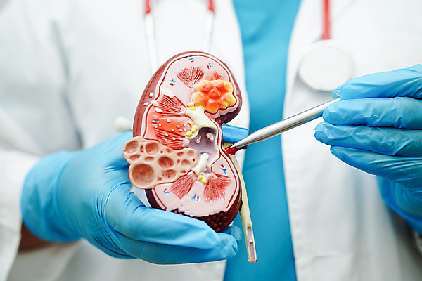 포토 JPG 해외이미지 건강 한명 들기 상반신 성인 펜 모형 의사 잡기 신장 질병 증상 성인한명만 해외202309 해외포토 1 의학 모션 사람 필기구 의료진 비뇨기관 성인만 파일형식