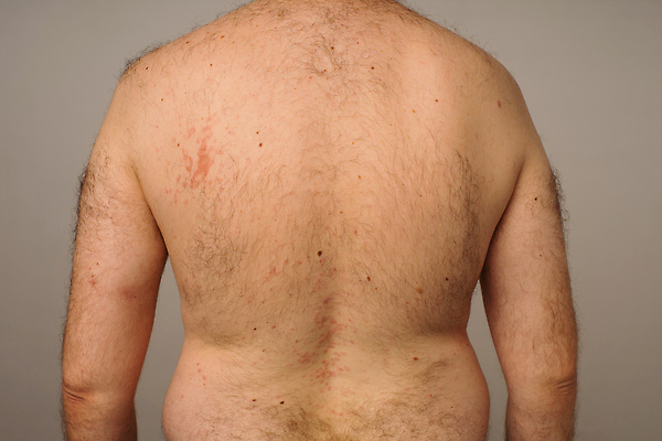 포토 JPG 해외이미지 손 얼굴 백그라운드 신체 사람없음 빨간색 고통 아기 바이러스 닫기 질병 피부 질감 감염 충격 알레르기 반응 심각 해외202309 해외포토 감정 컬러 컨셉 의학 모션 사람 신체부위 파일형식