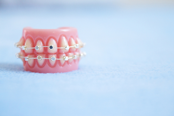 포토 JPG 해외이미지 모델 전통 백그라운드 건강 치과 병원 치료 세명 약 금속 장비 흰색 입 치아 오브젝트 치과의사 턱 틀니 돌봄 보철 치아교정 해외202309 해외포토 컬러 의학 모션 재질 사람 신체부위 의사 소화기관 교정 파일형식