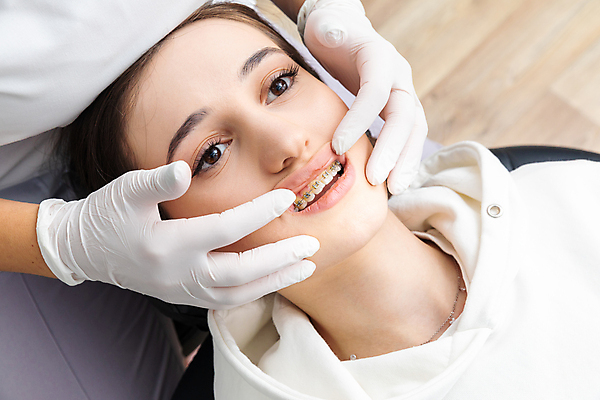 포토 JPG 해외이미지 백인 여자 건강 치과 병원 한명 사람 성인 치료 뷰티 약 금속 장비 시험 환자 의사 흰색 입 투명 닫기 치아 치과의사 철사 방문 돌봄 위생관리 치아교정 구강학 해외202309 해외포토 서양인 1 교육 컬러 의학 모션 재질 관리 신체부위 의료진 소화기관 교정 파일형식