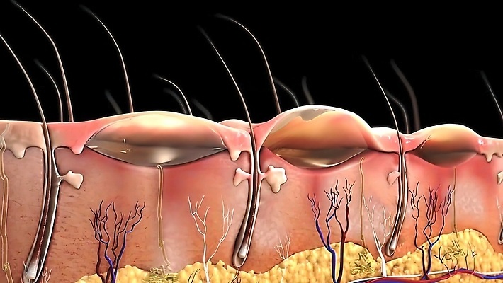 포토 JPG 해외이미지 손 디자인 신체 건조 건강 미술 사람 사람없음 빨간색 물 태양 약 고통 환자 짜증 조직 질병 피부 생물학 감염 문제 암 토막 알레르기 돌봄 반응 염증 증상 화상 못생김 해외202309 해외포토 자연요소 교육 감정 컬러 의학 모션 문화예술 신체부위 상처 파일형식