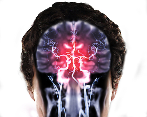 포토 JPG 해외이미지 얼굴 엑스레이 건강 병원 사람없음 치료 머리 고통 환자 질병 뇌 함선 두통 동맥 고립 종양 타격 해골모형 혼란 해외202309 해외포토 감정 컨셉 배_교통 의학 모션 신체부위 모형 혈관 파일형식