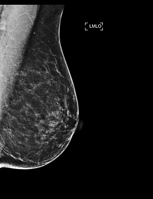 포토 JPG 해외이미지 여자 2 건강 병원 사람없음 시험 환자 의사 성장 수비 오르간 질병 가슴 확인 예방 유방암 암 외과 발견 의심 방사선 탐지 해외202309 해외포토 교육 감정 의학 모션 사람 신체부위 의료진 건반악기 파일형식